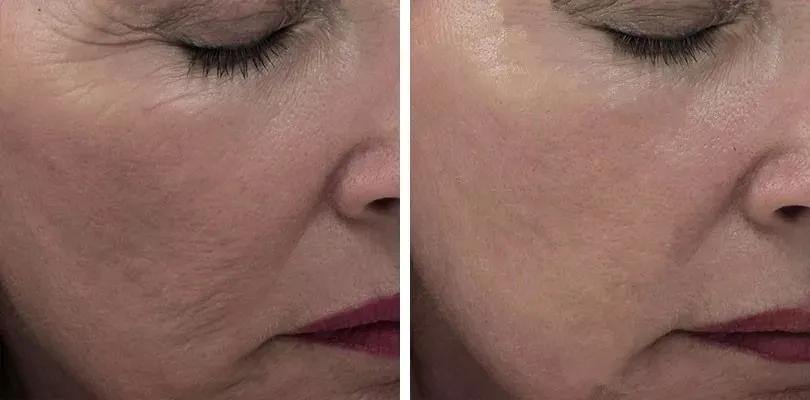 美白祛黄提亮肤色泡水喝,每天喝一杯可以美白淡斑清热解毒