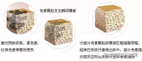 桃树褐斑穿孔病治疗方法,褐斑怎么治疗最有效