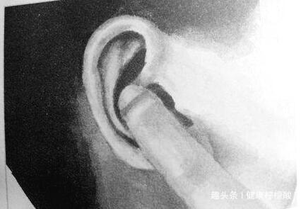 耳鸣频发何以解忧！这几个方法让你安稳无忧