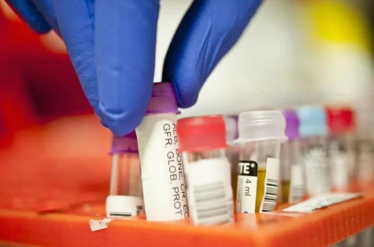 同型半胱氨酸高对心脑血管的影响,同型半胱氨酸高引起心血管痉挛