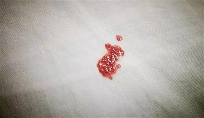 月经量少经期不规律会影响怀孕吗,月经量少与不排卵有关系吗