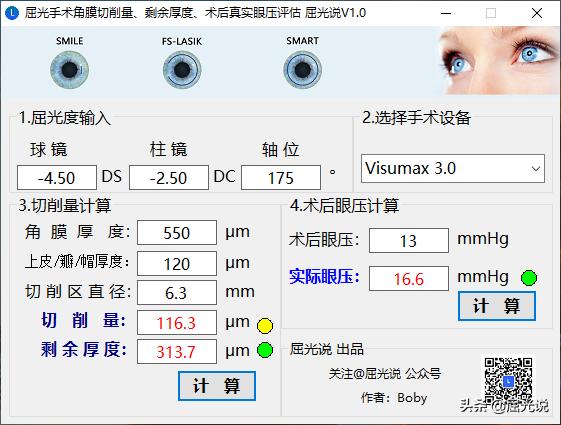 近视手术测视力,近视手术术前视力预估
