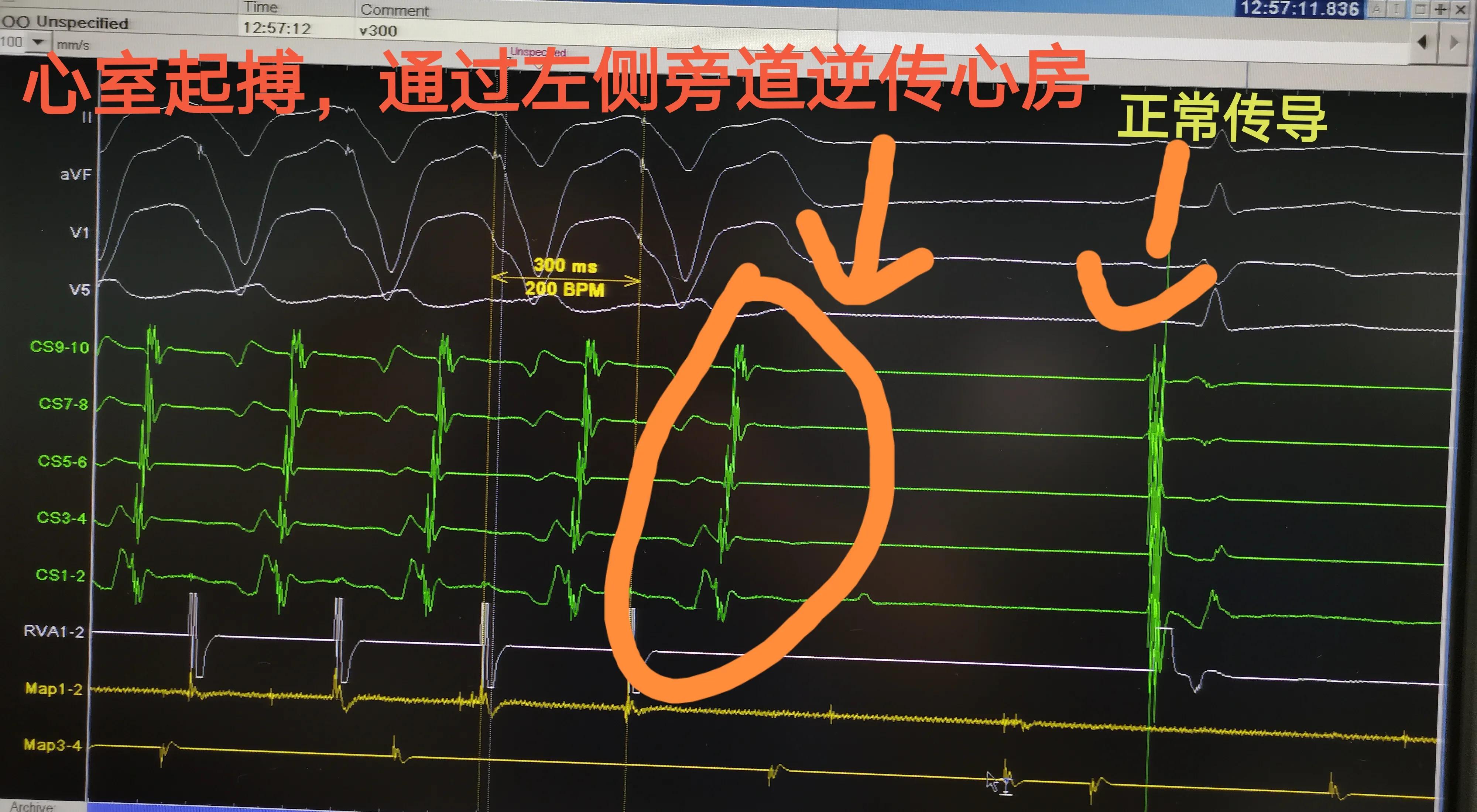 缁欒繙鍦ㄤ粬涔＄殑缃戝弸鎯呬功,缁欒繙鍦ㄤ粬涔＄殑缃戝弸瀵勪粈涔堢ぜ鐗╁ソ