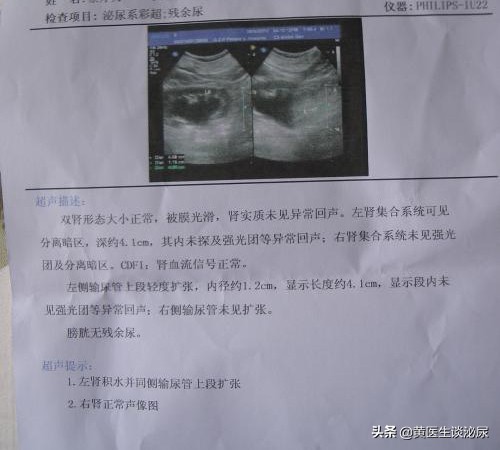 半夜尿结石肚子痛怎么办,半夜结石疼去医院怎么办