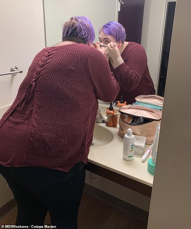 24岁女生胡须浓密,25岁女生胡须浓密