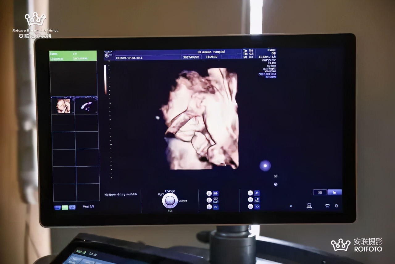 孕期检查做几次四维彩超,孕期产检需要做几次肝胆彩超