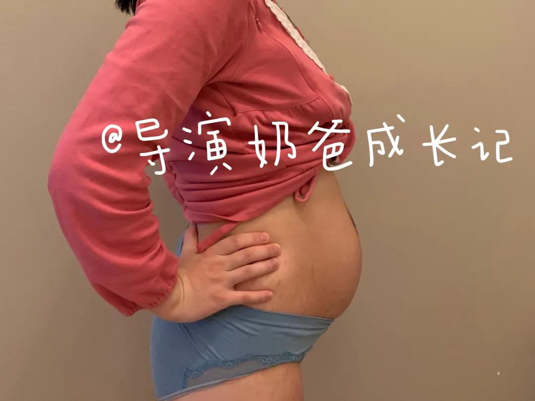 三指半到闭合,一个双胞胎妈妈的腹直肌康复之路