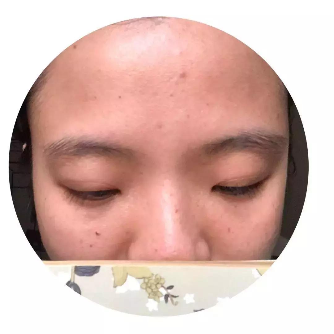 皮肤改造计划丨去痘印、美白、淡化眼部细纹，解决问题并不贵~