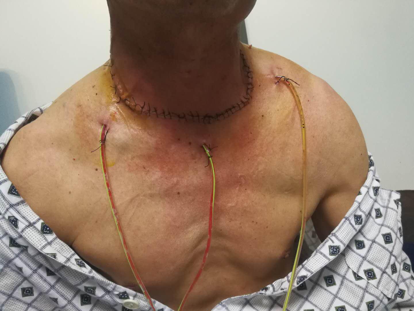 日照中医院治疗肿瘤的医生,日照中心医院特色科室