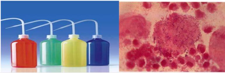 引起女性私密疾病原因有哪些？