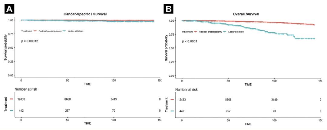 前列腺癌消融好还是手术好,前列腺癌粒子植入和切除的比较