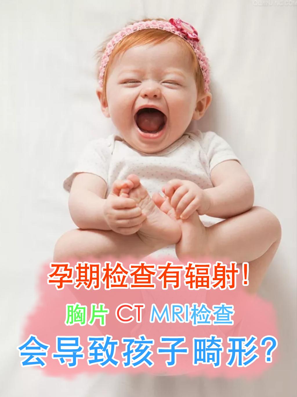 胸片b超的辐射量,医生给孕妇做b超导致婴儿畸形