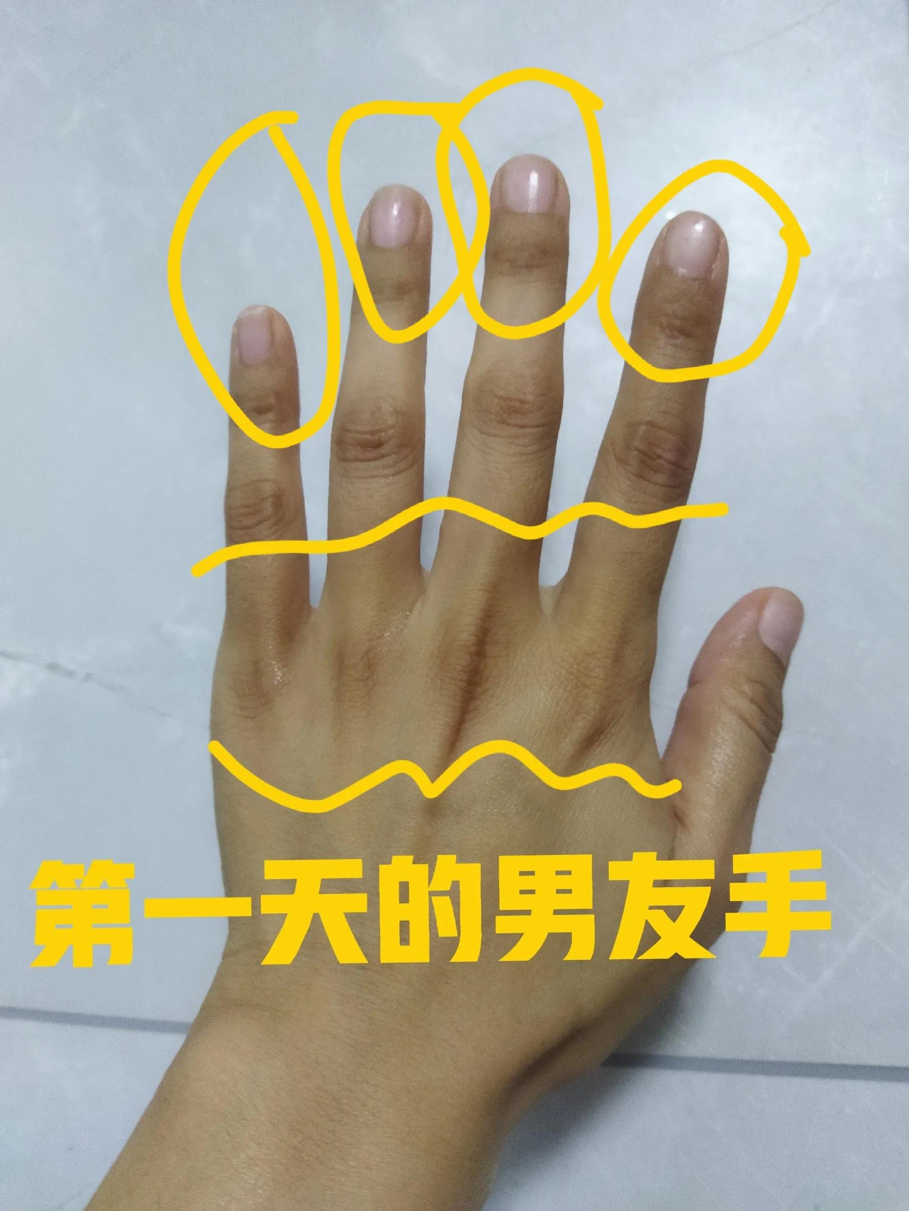 手肘膝盖发黑怎么治疗,手肘关节处变黑是什么原因