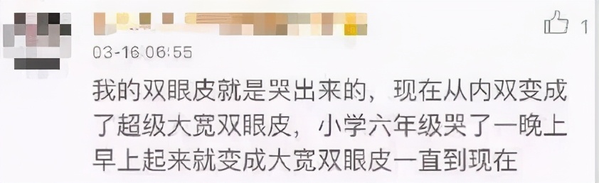 双眼皮不要盲目跟风,别割双眼皮