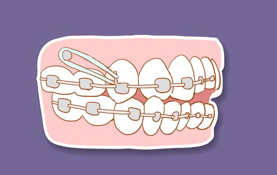 凸嘴女孩的发型侧面好看,水原希子是什么脸型