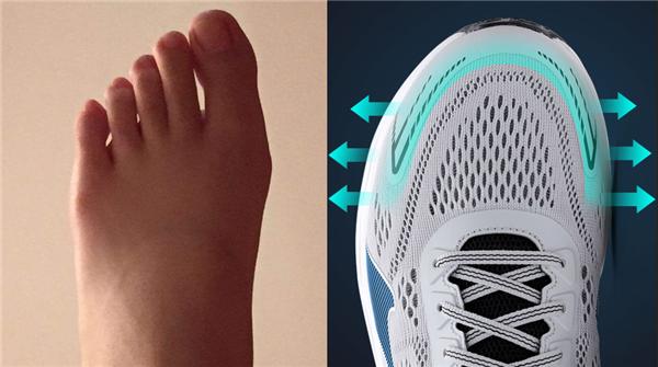 正确的选鞋方法和技巧,骨科医生教你5个挑好鞋的技巧