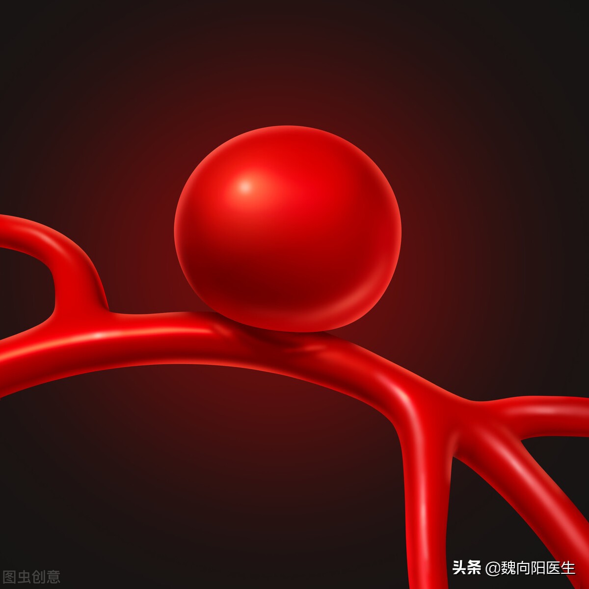 颅内动脉瘤做开颅还是介入好,颅内动脉瘤是介入好还是开颅好