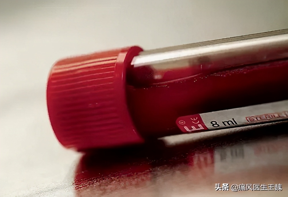 痛风怎样诊断需要做什么检查,痛风的诊断与治疗口诀