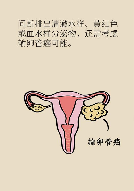 这些问题每个女性都有，稍不注意就会变成大病！