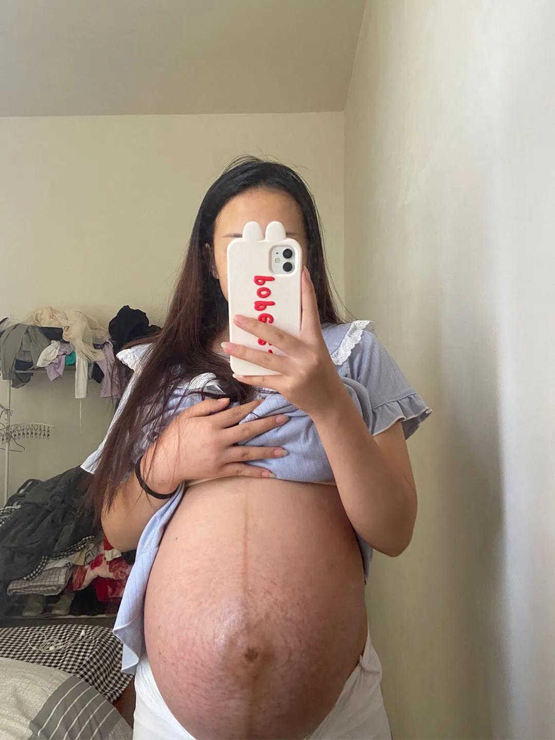 收腹带会影响子宫收缩吗,收腹带对子宫下垂有帮助吗