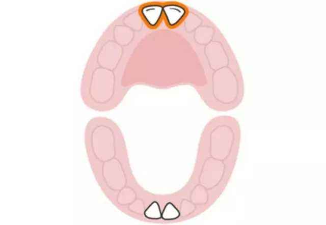 孕期可以看出胎儿牙齿好坏吗,胎儿牙齿发育的过程视频