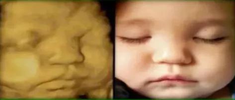 孕期超声检查须知,准妈妈必读产前超声小课堂