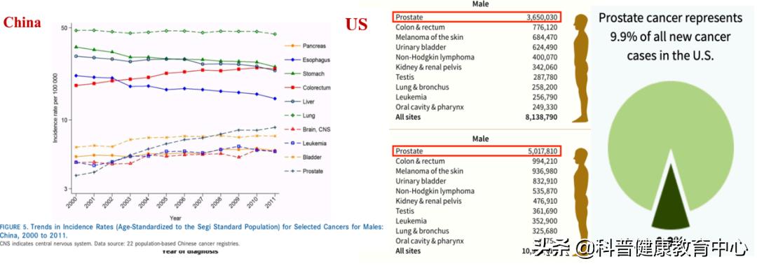 前列腺癌筛查专家共识,泌尿外科科普前列腺癌