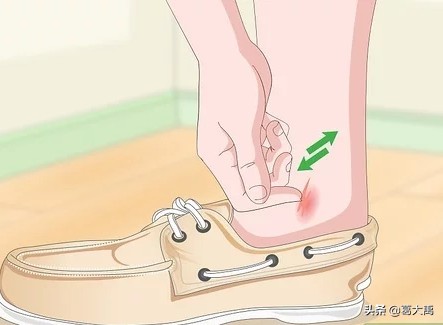 夏季如何辩认跳蚤的咬痕