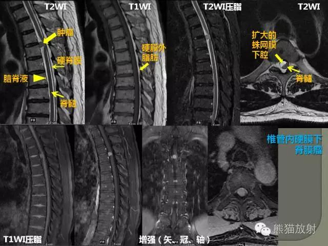 如何简单理解、认识MRI图像