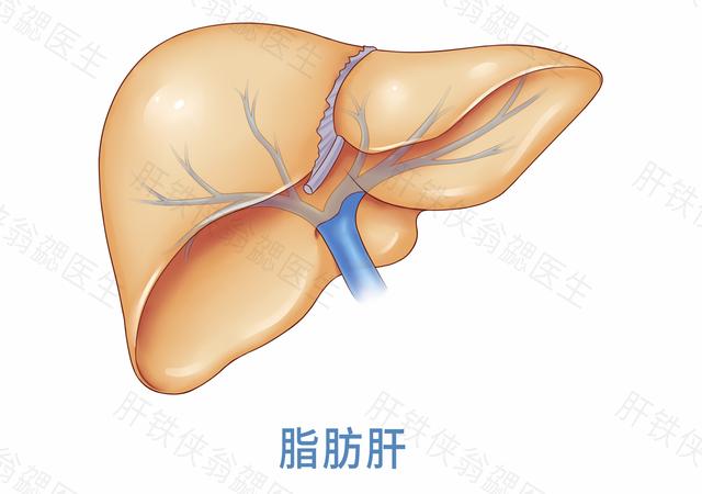 脾大会误诊吗,疑似脾大需要治疗吗