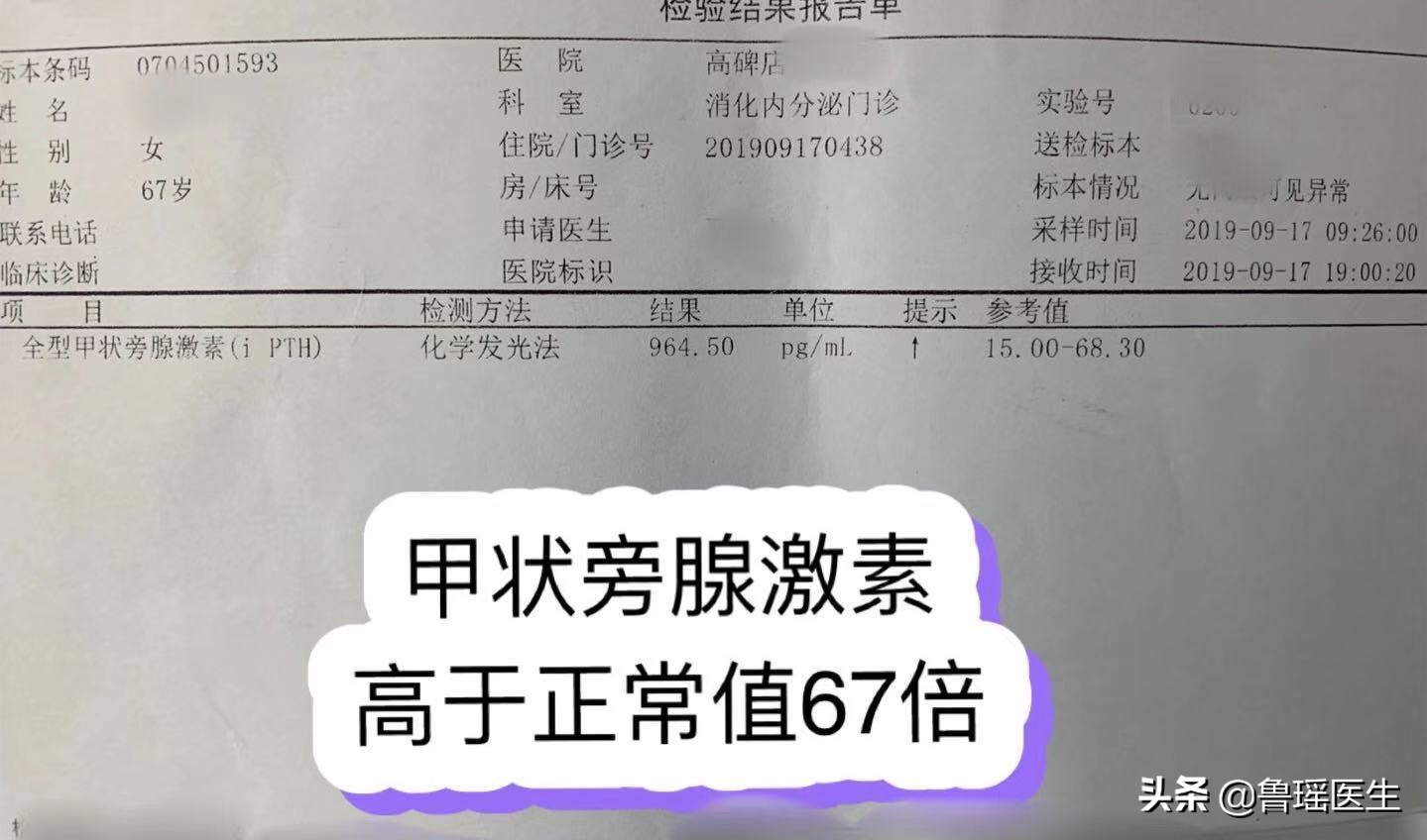 尿道结石会导致腹胀消化不良吗,关节炎和尿路结石是什么代谢异常