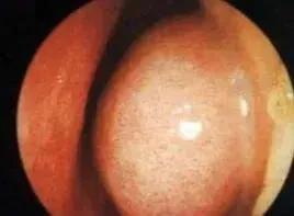 冬季儿童应常备哪些药品,家里常备儿童的药