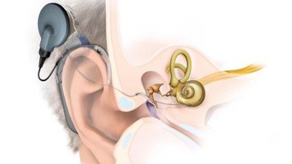 新生儿检查听力没有通过,双耳检查听力不通过
