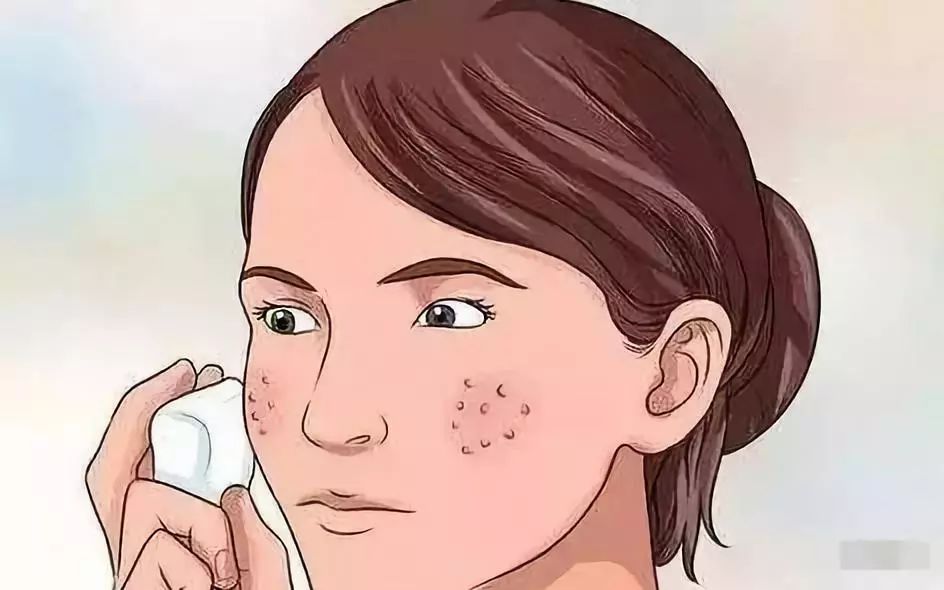 毛孔粗大怎么办最有效收缩毛孔,毛孔粗大用什么方法收缩毛孔