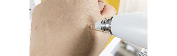 inface美容仪器小章鱼黑头吸出器,小米米粉最新款