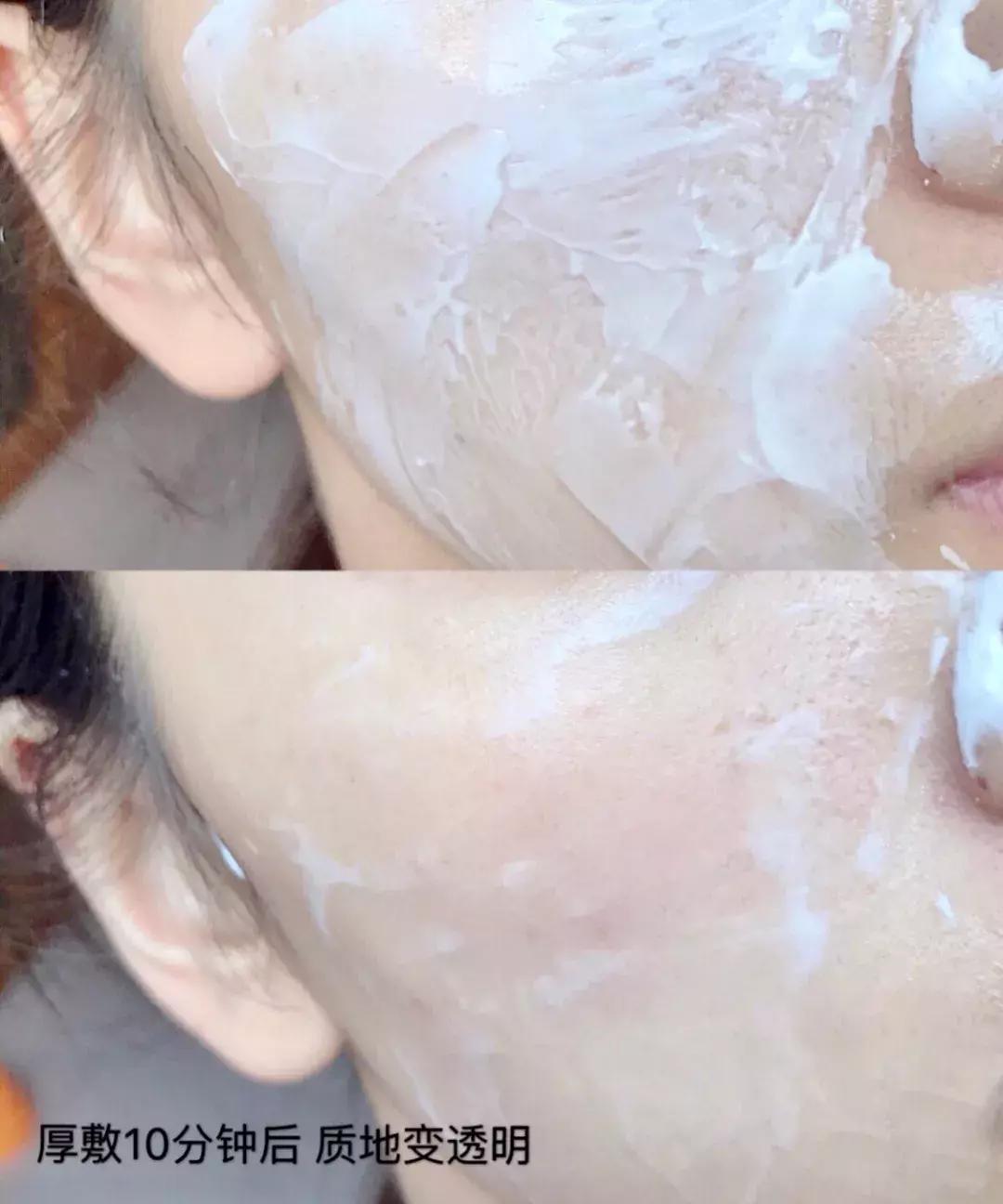 日本复活草面膜敷完后长闭口,日本复活草面膜晒后修复