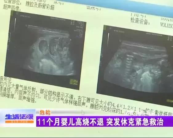 11个月宝宝发烧吃药不退怎么办,11个月宝宝感染病毒高烧不退