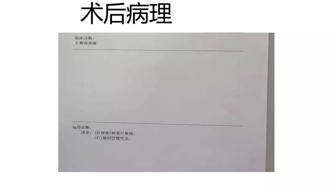 卵巢原发肿瘤的分析思路