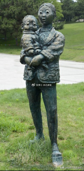 产后弹响髋,产后髋关节不对称的原因