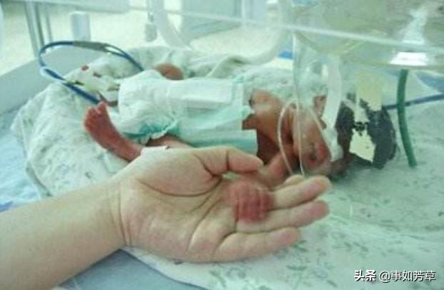 胎儿分娩时仅36周，宝妈怀疑宝宝抓破孕肚，医生：不是这么回事