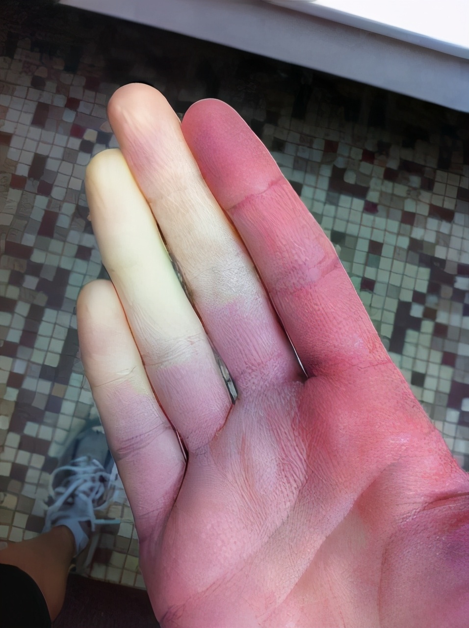 女孩手凉是什么原因,女孩子手凉怎么办快速缓解