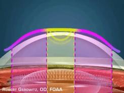 古代人近视如果没有眼镜怎么办,古代人近视时是怎样的