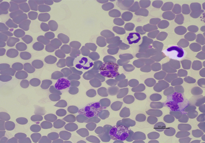 辟谣，猫咪白细胞激增就是患病？主人被告知：压力也会导致其升高