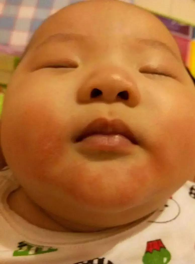 捏宝宝脸流口水,捏宝宝脸颊导致流口水吗