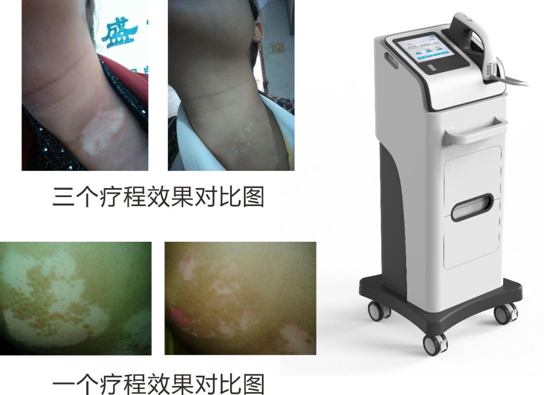 附近的皮肤病专科医院在哪,附近专治皮肤病的医院