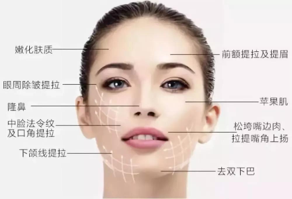 科普线雕会有哪些后遗症,线雕解密