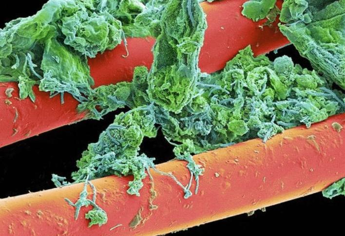 放大两千倍的牙齿表面长什么样？不愧是人体最脏的地方，不堪入目