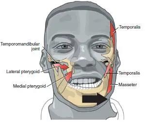 下巴歪斜矫正图,下颌紊乱大小脸矫正