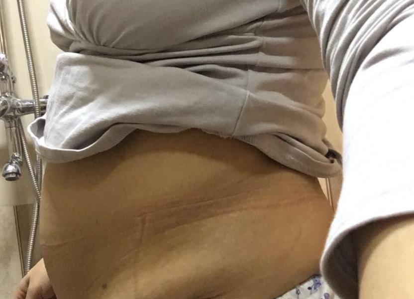 产后收腹带能代替运动束腰带吗,产后束缚带可以护腰吗