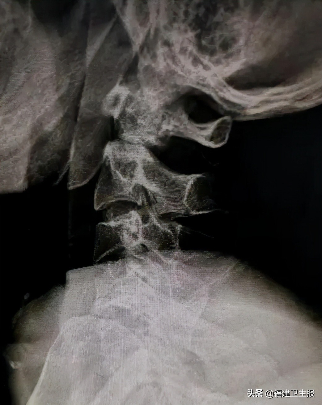 娉夊窞绗竴鍖婚櫌棰堟鎵嬫湳,娉夊窞鍖婚櫌棰堟寰垱